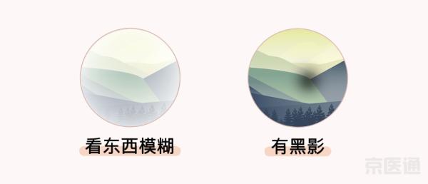 同仁醫(yī)生:4個眼科測試圖,1分鐘測眼睛是否健康！