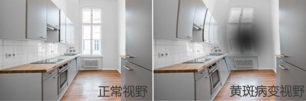 同仁醫(yī)生:4個眼科測試圖,1分鐘測眼睛是否健康,！