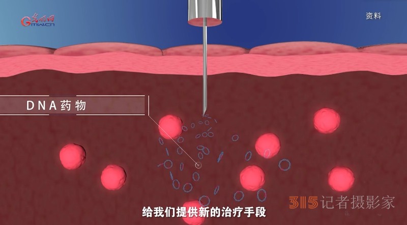 宮頸癌消滅戰(zhàn):如何減少“梅艷芳式悲劇”,? 宮頸癌消滅戰(zhàn):如何減少“梅艷芳式悲劇”?